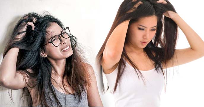 Home Remedies Itchy Scalp
